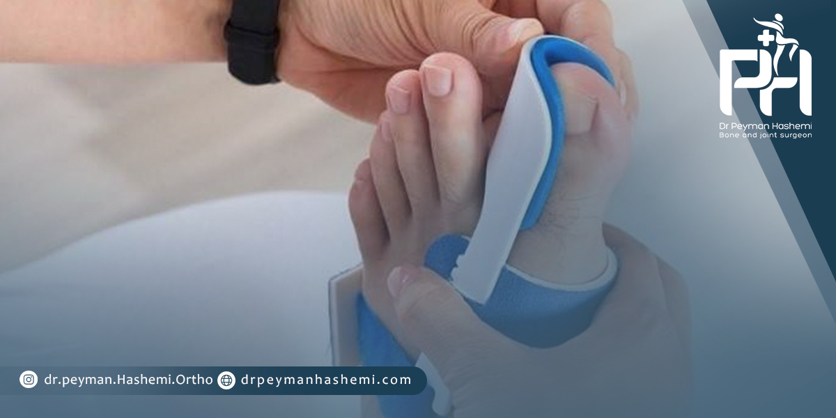عوامل ایجاد کننده هالکوس والگوس