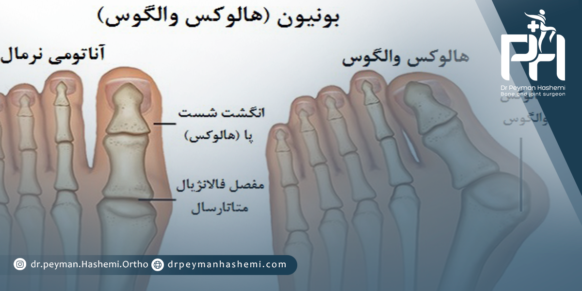  فیزیوتراپی و ورزش