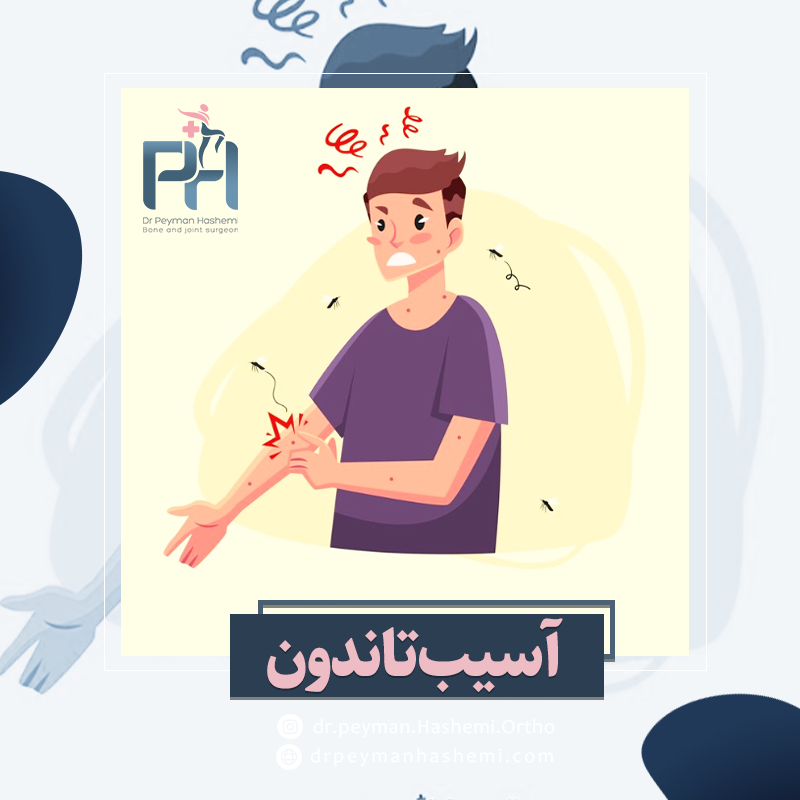 درمان آسیب تاندون
