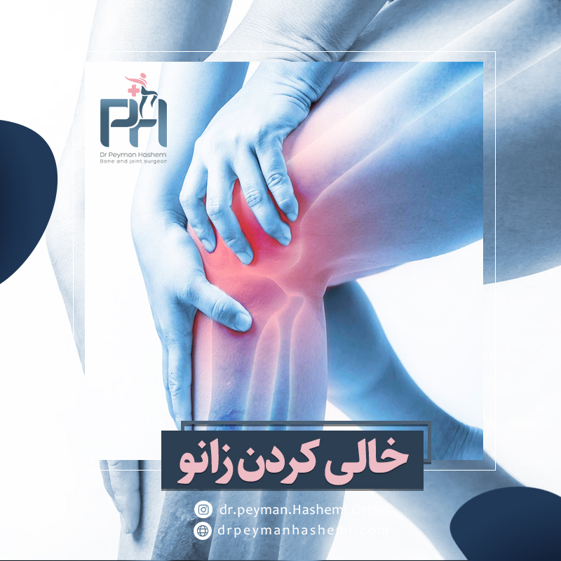 خالی کردن زانو