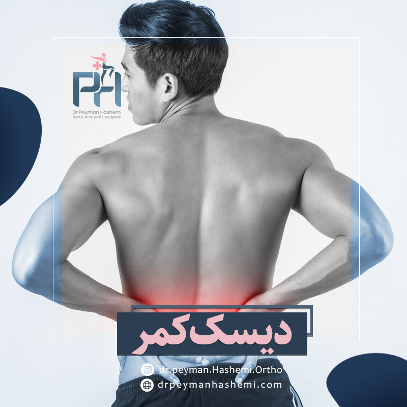 عمل بسته دیسک کمر