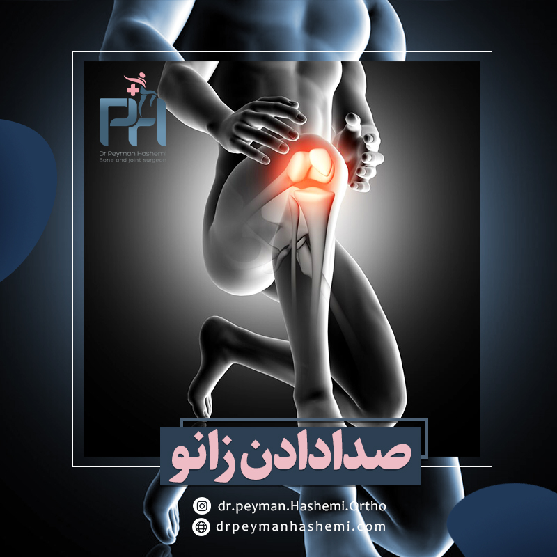 درمان صدادادن زانو