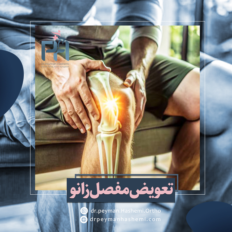 تعویض مفصل زانو برای افراد دیابتی