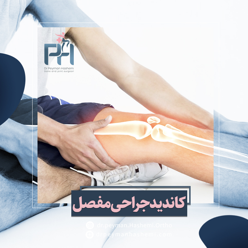 افراد کاندید جراحی مفصل زانو