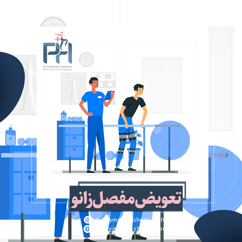 مراقبت های بعد از تعویض مفصل زانو