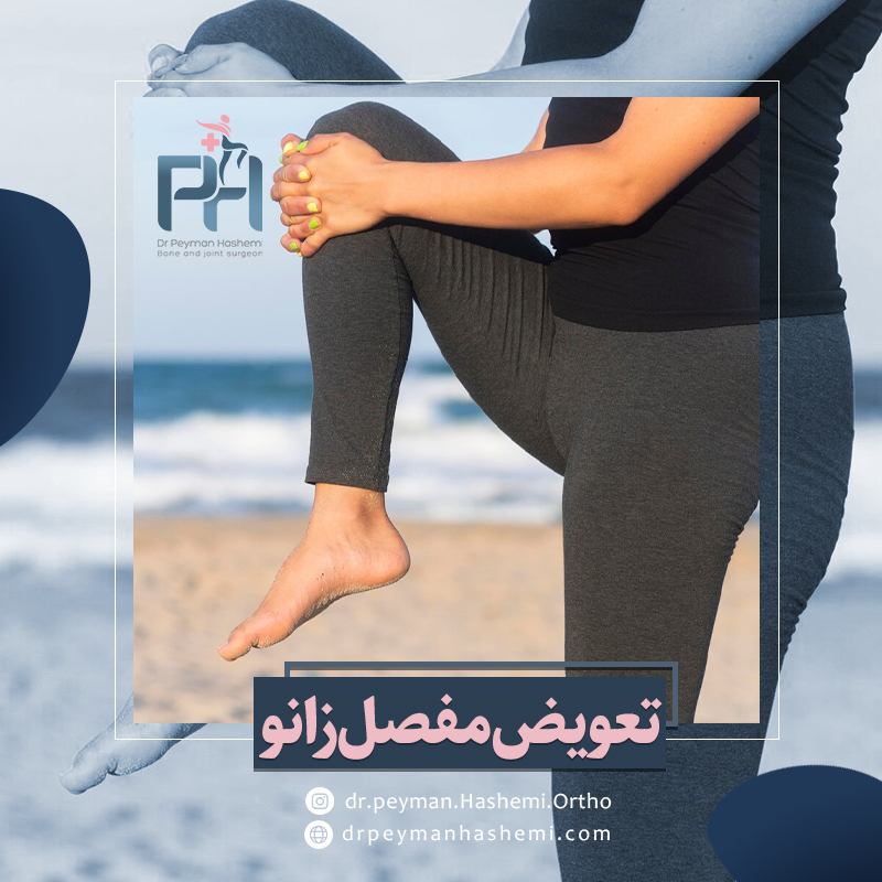 مراقبت از مفصل زانو