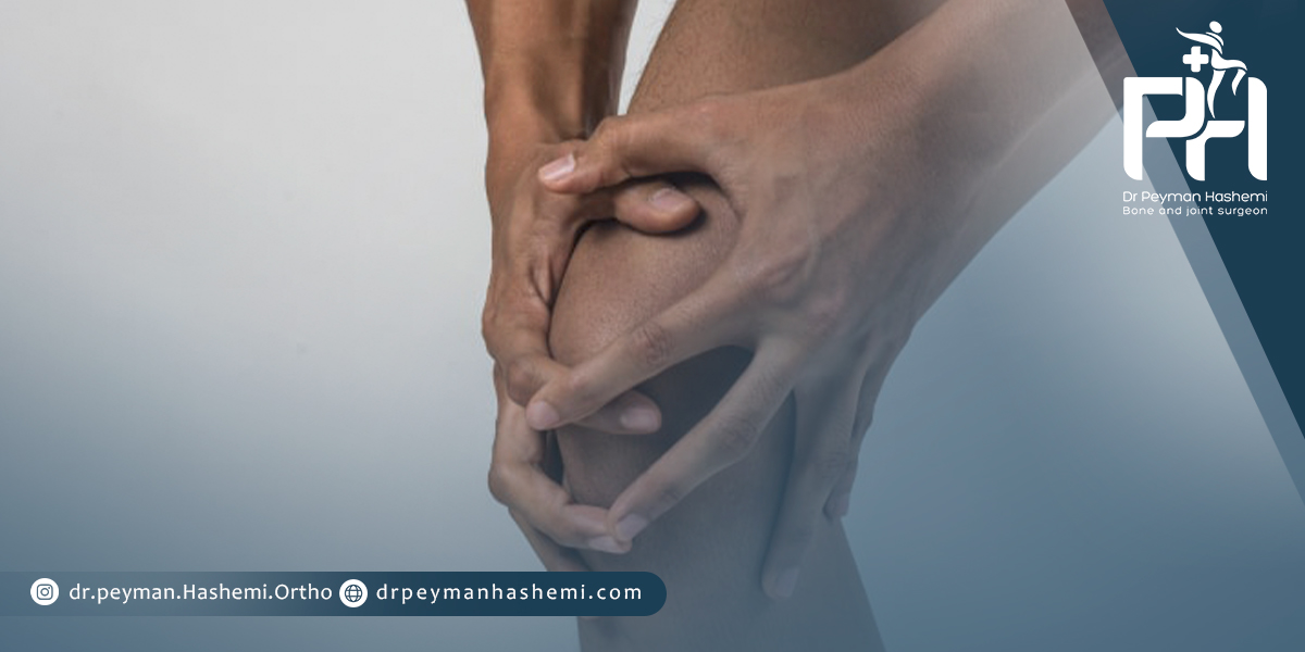 چه افرادی نیاز به تعویض مفصل زانو دارند؟