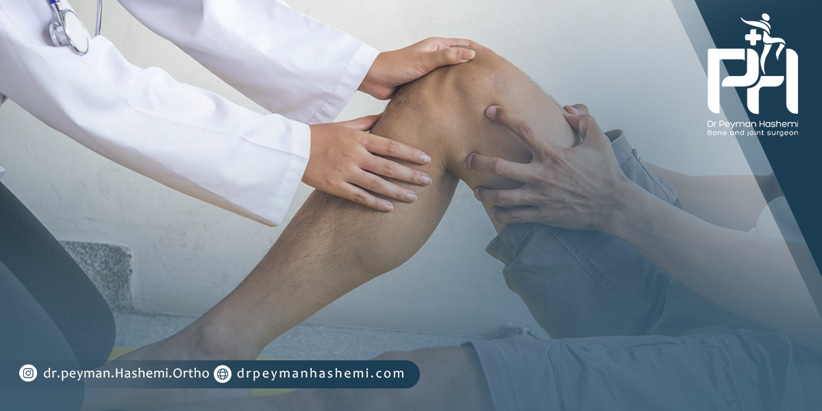 عوارض احتمالی پس از تعویض مفصل زانو