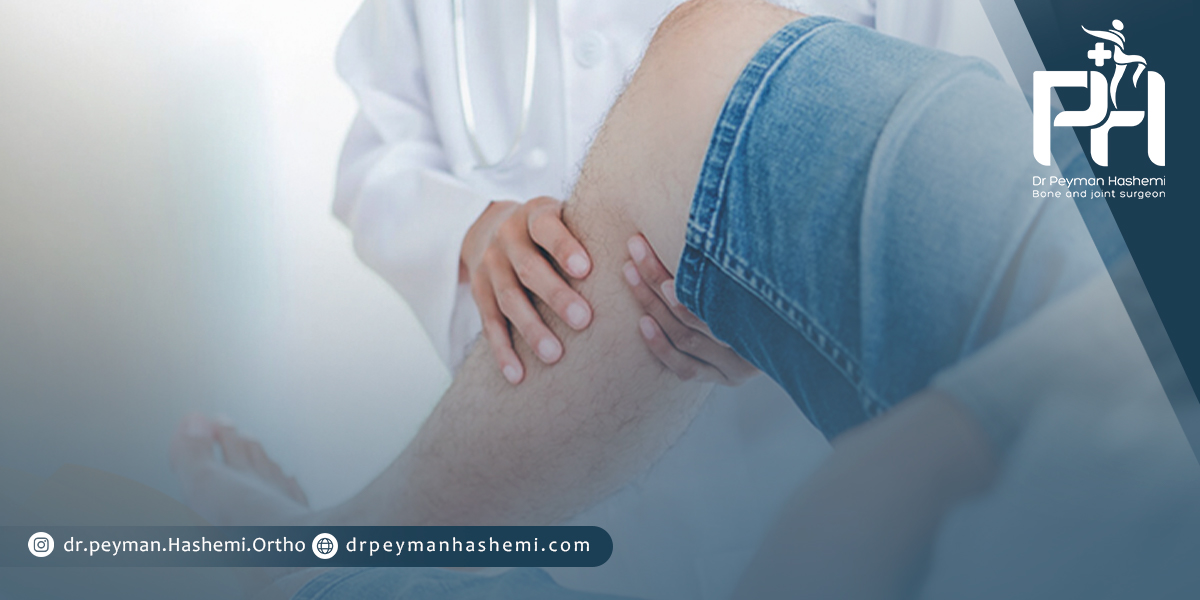 پیشگیری از فرسایش مفصل زانو