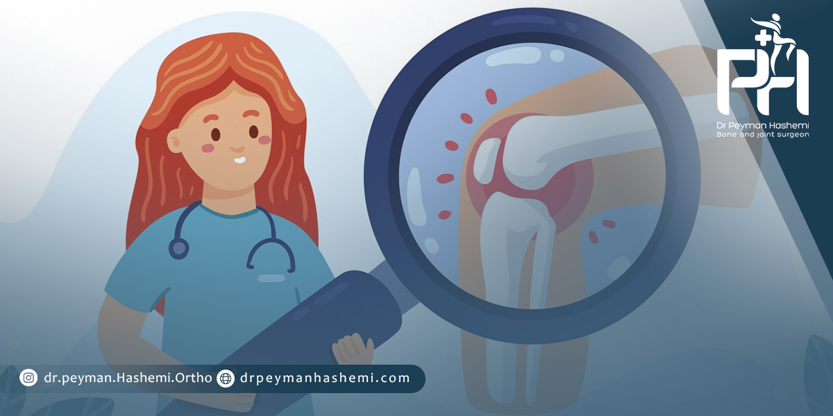 نکات مراقبتی بعد از تعویض مفصل زانو