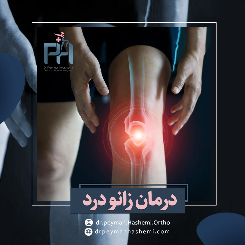 درمان‌ زانو درد